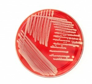 iStock_000014067437Small petri dish
